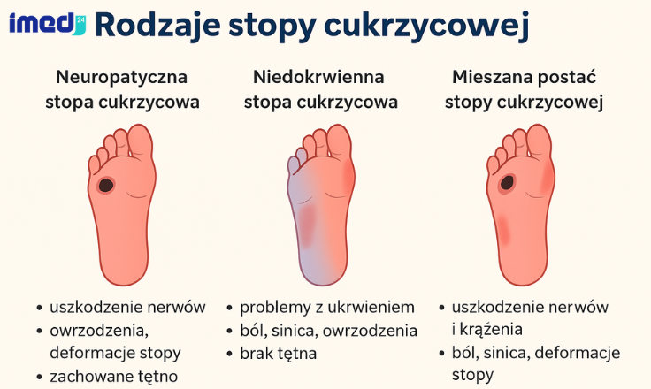 Rodzaje stopy cukrzycowej