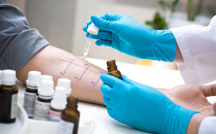 Testy na alergię - wskazania i rodzaje